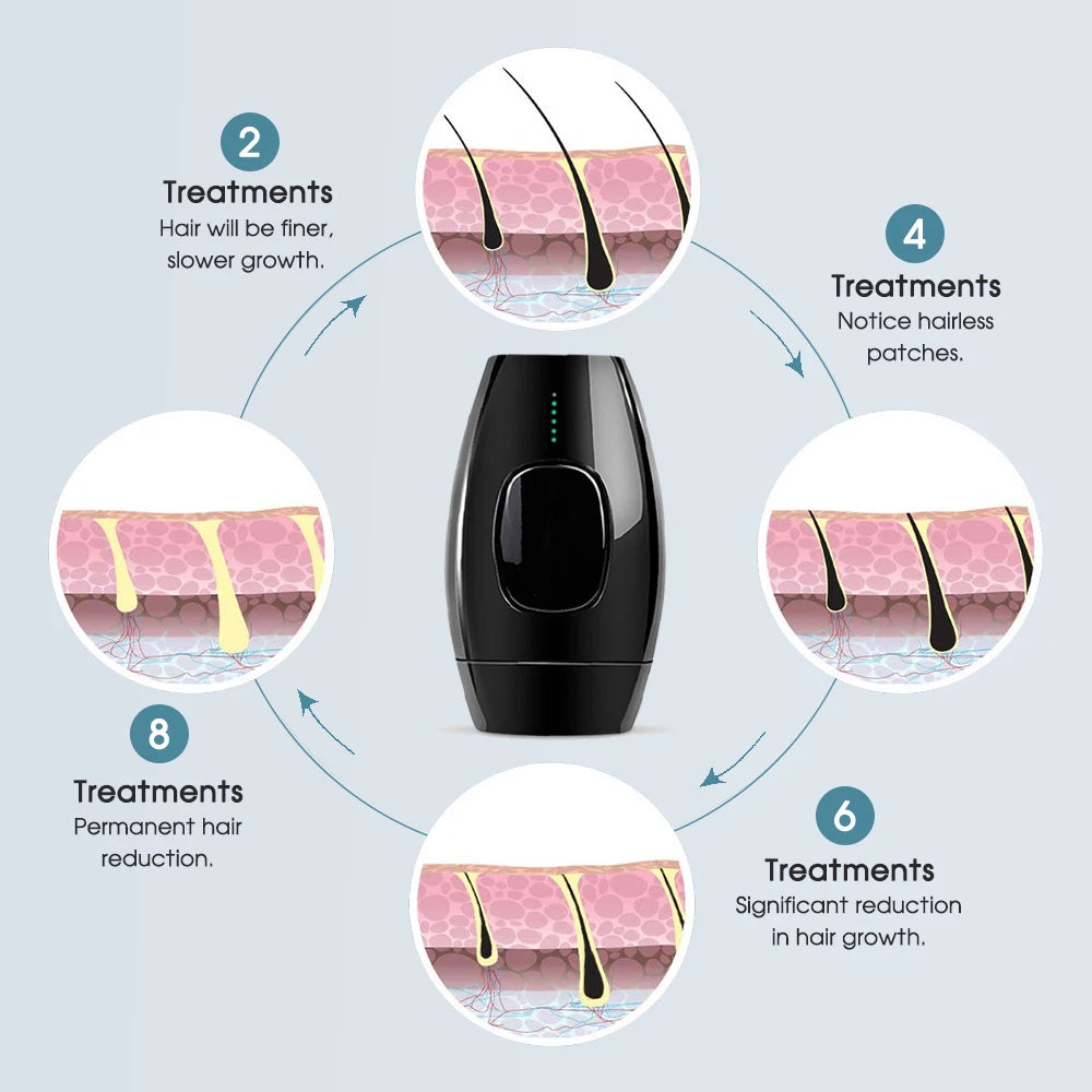 Laser Hair Removal Epilator - GPeak
IPL device for painless permanent hair removal
Hair remover gadget with laser technology